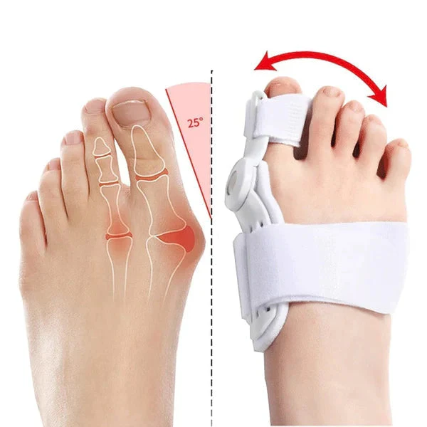 Bunion Toe Shaper - BUY 1 GET 1 FREE - Image 3