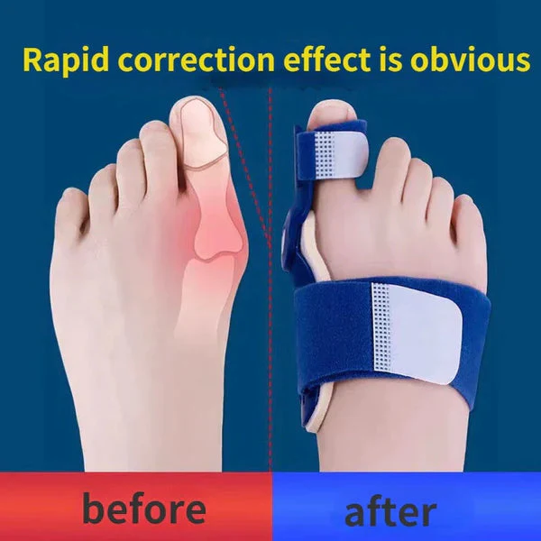 Bunion Toe Shaper - BUY 1 GET 1 FREE - Image 7