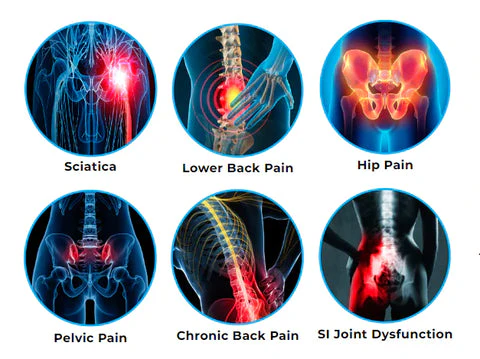 Sciatica Joint Relief Hip Belt (Free Shipping + COD Available) - Image 11
